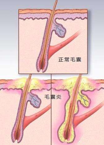 第336頁