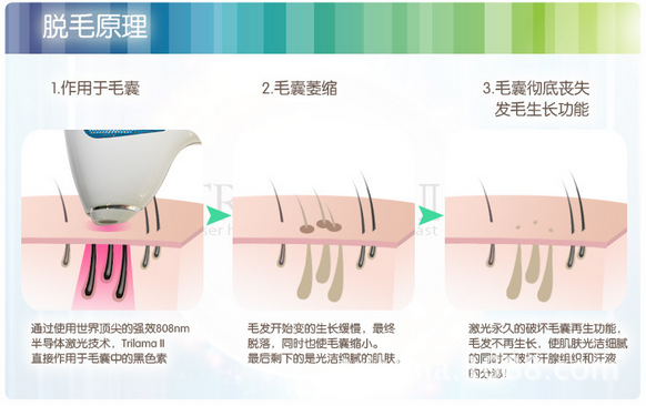 永久脫毛對身體有害嗎？全面解析脫毛方法與潛在風(fēng)險(xiǎn)，全面解析永久脫毛方法與潛在風(fēng)險(xiǎn)，對身體有害嗎？