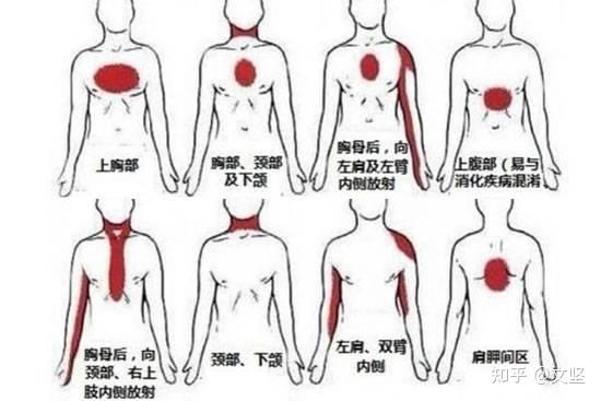 后背疼痛位置圖詳解，了解疼痛源頭，有效緩解不適，后背疼痛詳解，位置圖助你了解疼痛源頭，有效緩解不適